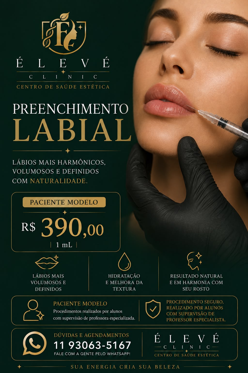 Close dos lábios após preenchimento labial