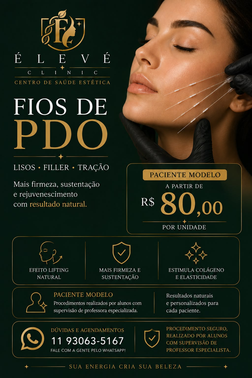 Tabela de valores para paciente-modelo de fios de PDO