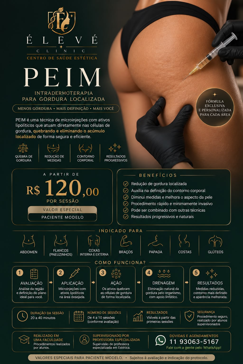 Tabela de valores para paciente-modelo do PEIM para gordura localizada