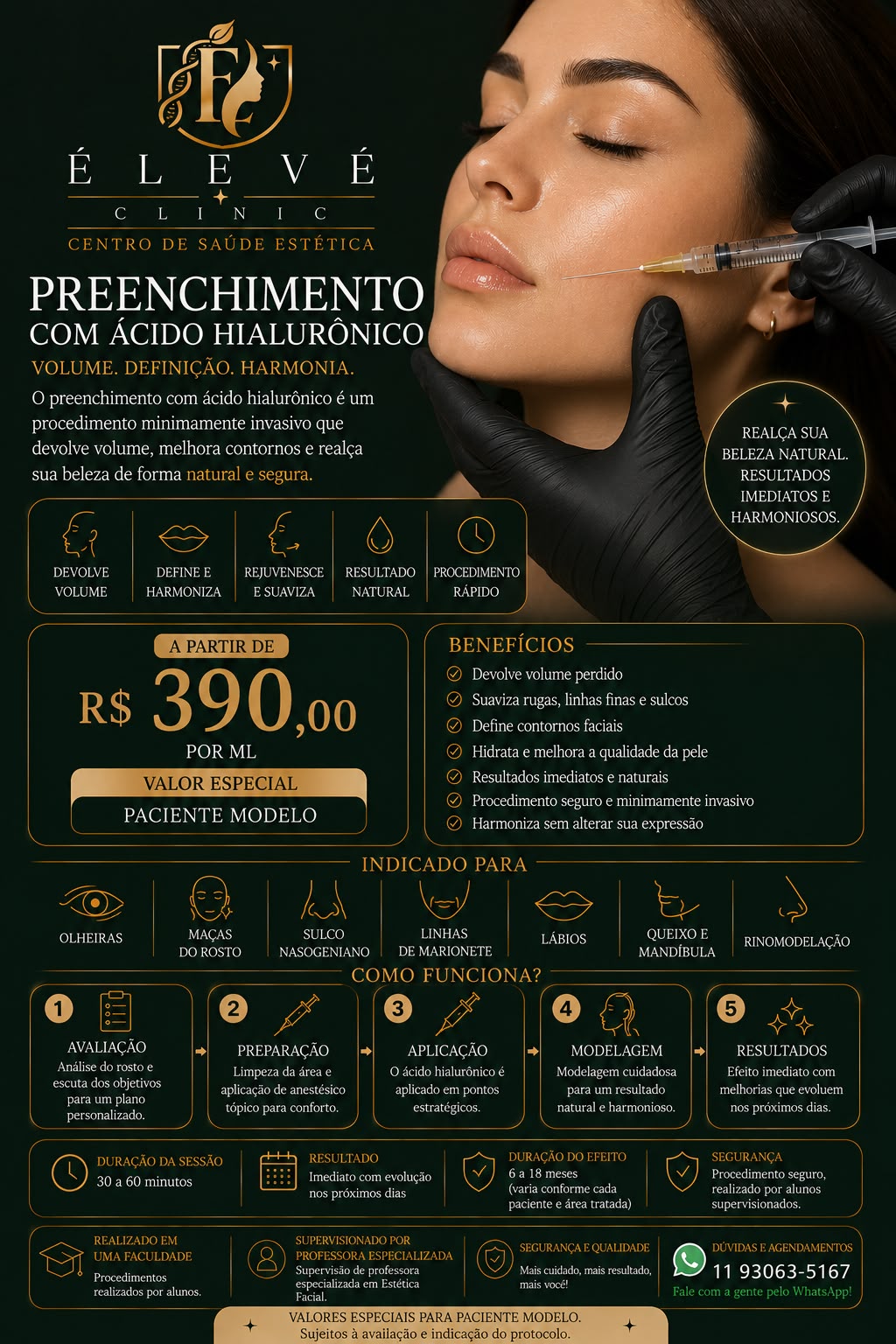 Tabela de valores para paciente-modelo de preenchimento facial com ácido hialurônico
