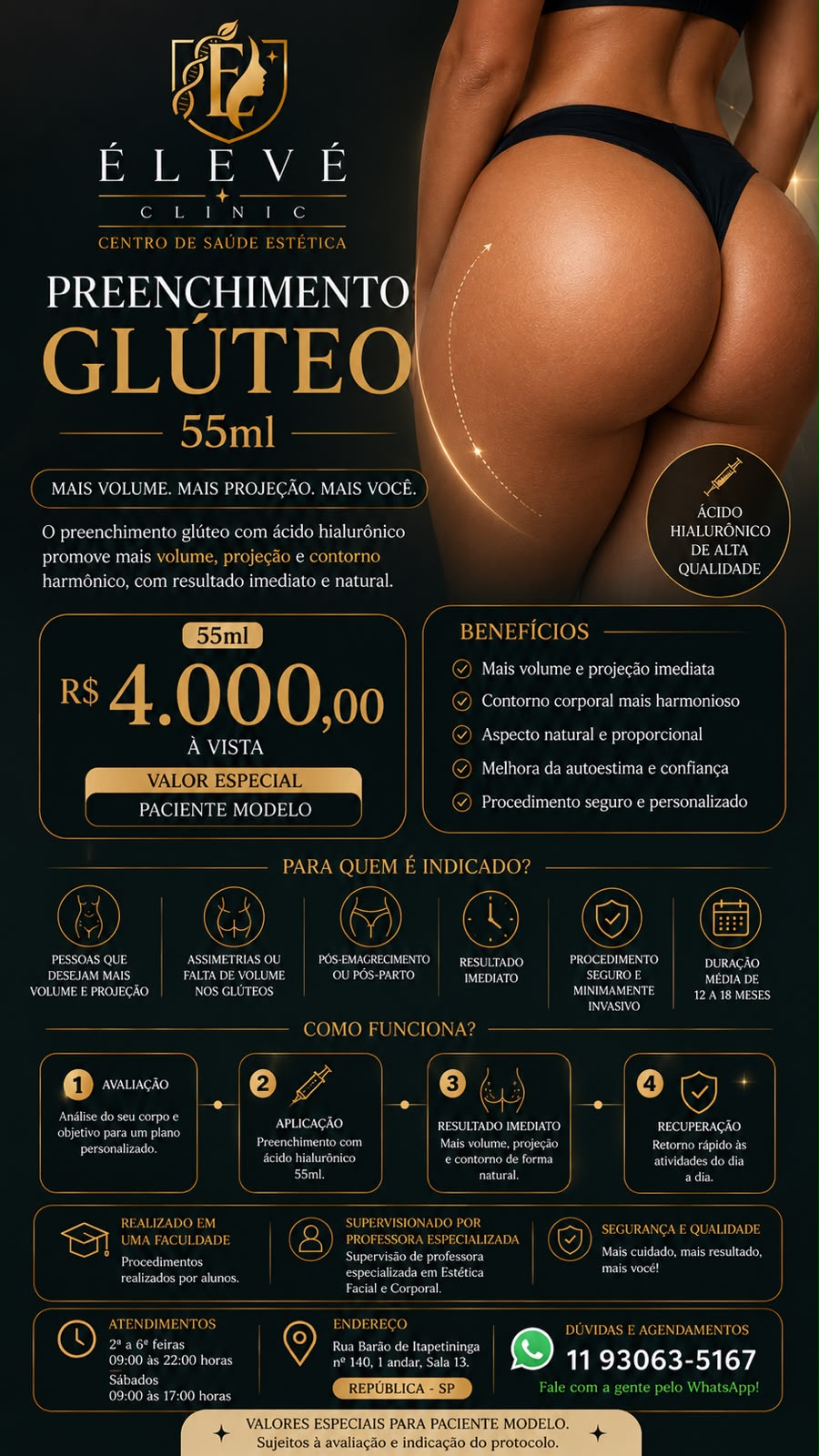 Tabela de valores para paciente-modelo de preenchimento glúteo com ácido hialurônico