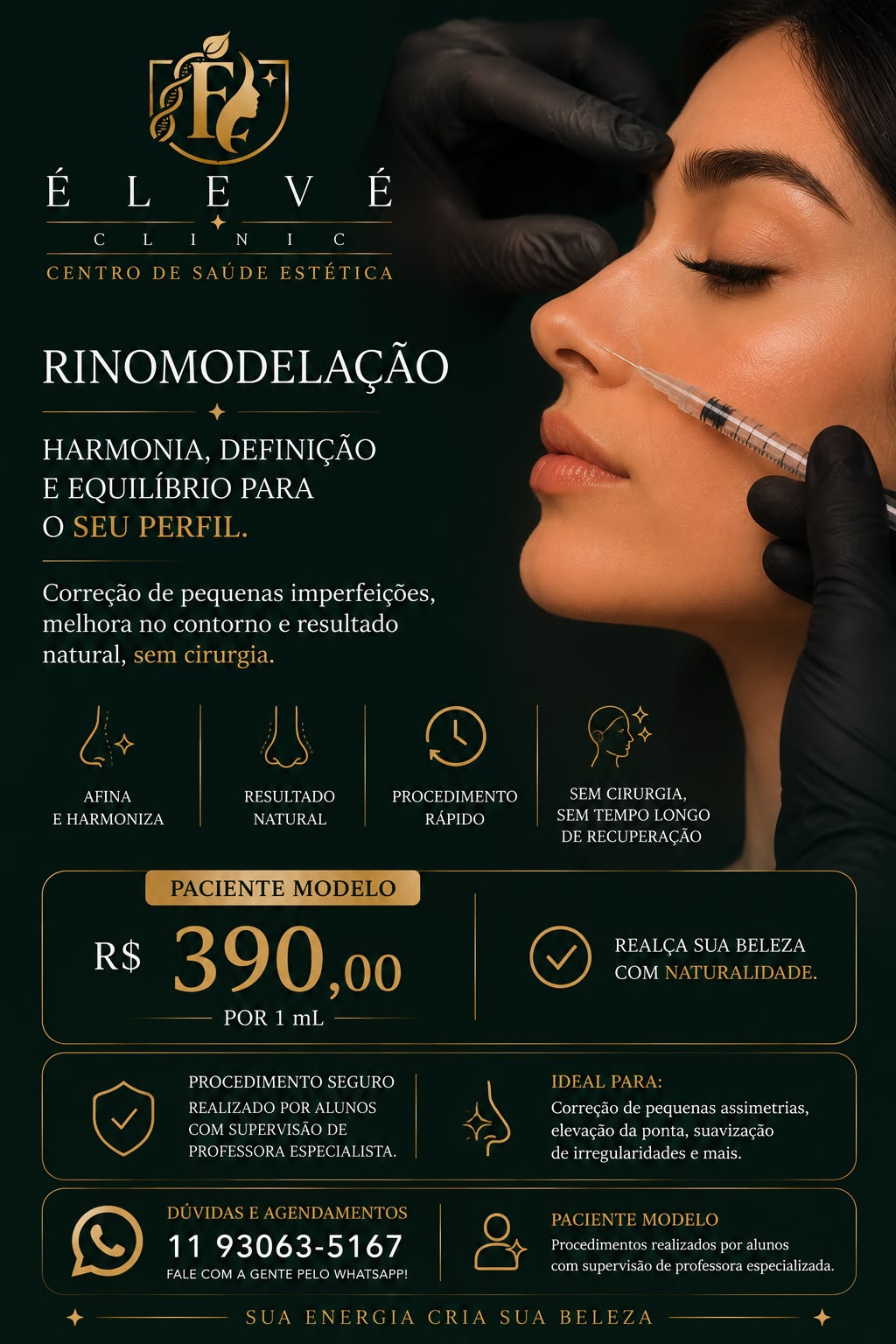 Tabela de valores para paciente-modelo de rinomodelação