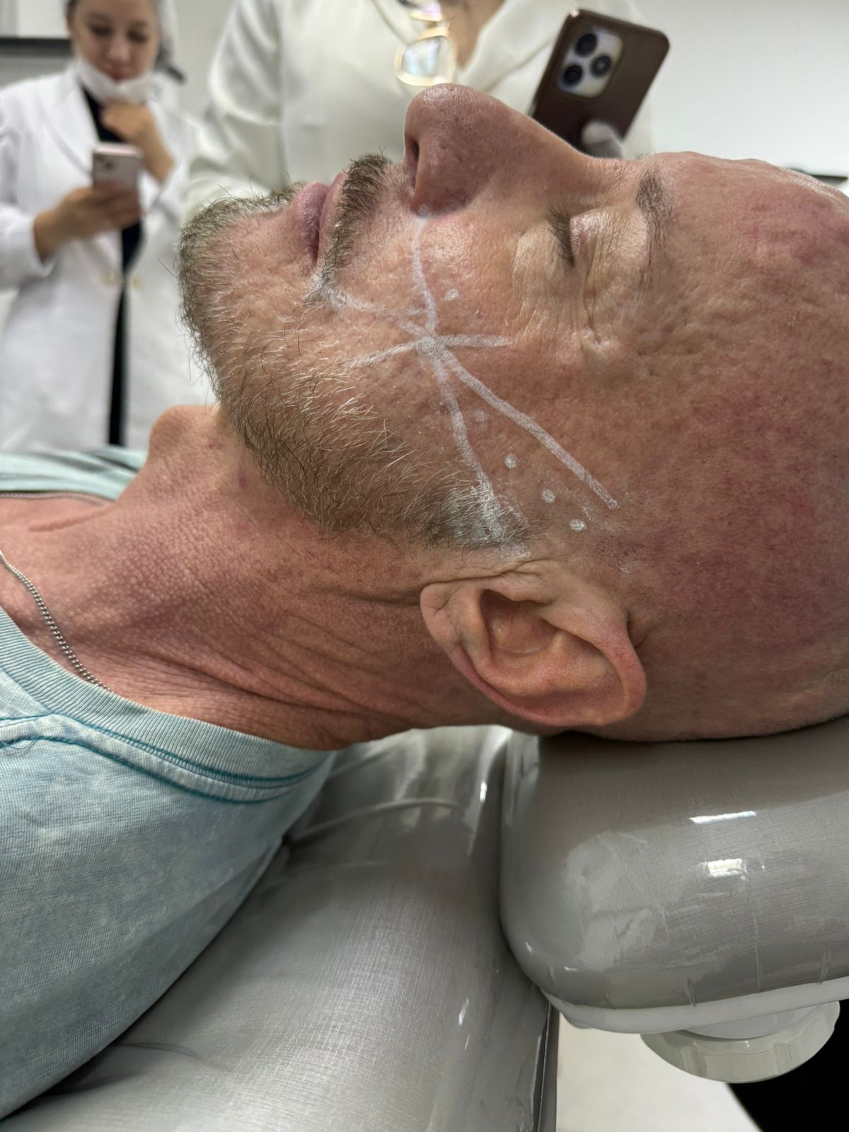 Marcação facial antes de procedimento na ÉLEVÉ Clinic