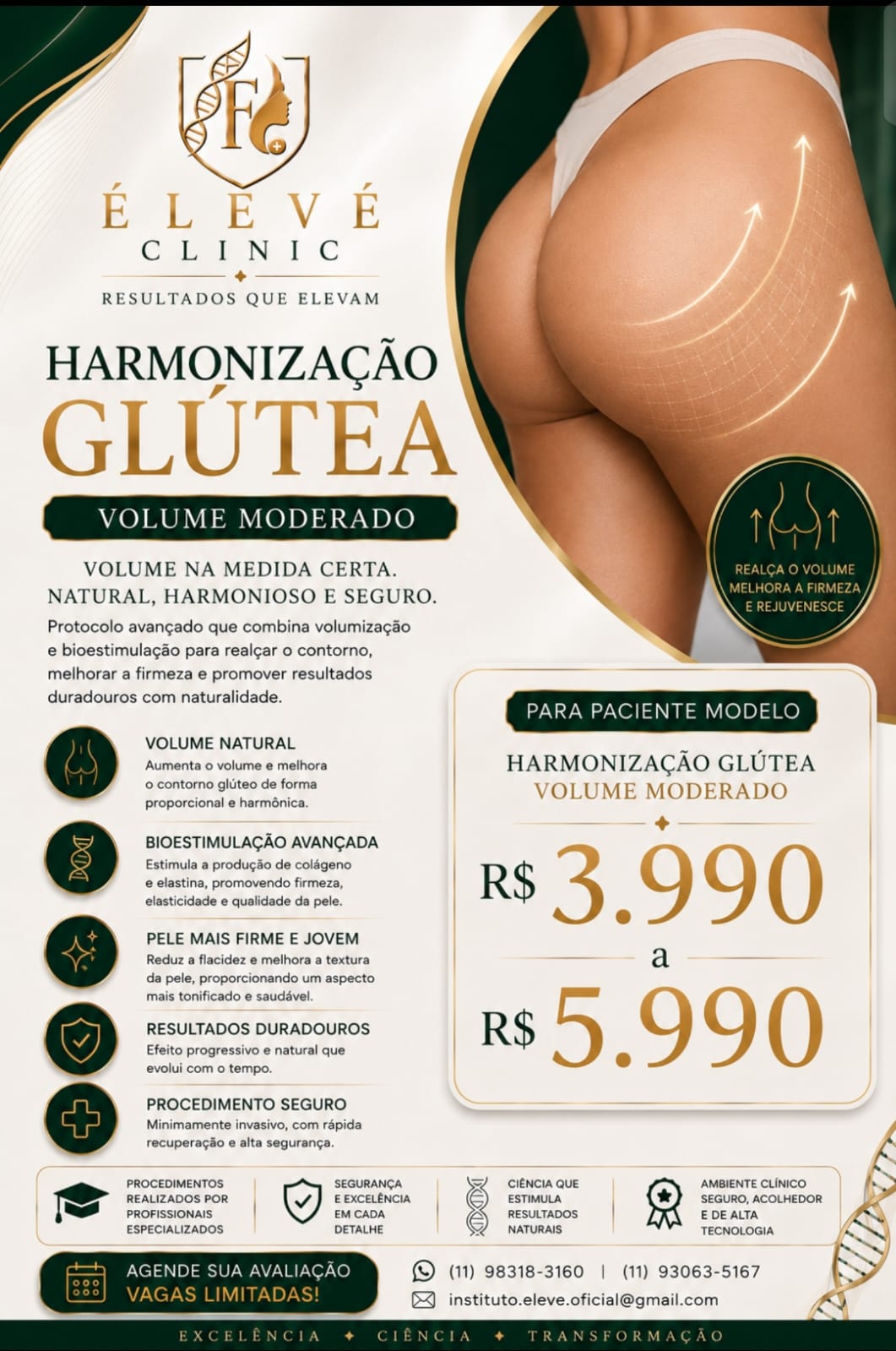 Divulgação de paciente-modelo para harmonização glútea com volume moderado